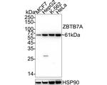 Pokemon Antibody in Western Blot (WB)