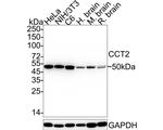 TCP-1 beta Antibody in Western Blot (WB)