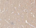 Dynamin 1 Antibody in Immunohistochemistry (Paraffin) (IHC (P))