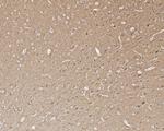 Dynamin 1 Antibody in Immunohistochemistry (Paraffin) (IHC (P))