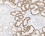 ALDH4A1 Antibody in Immunohistochemistry (Paraffin) (IHC (P))