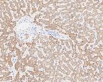 ALDH4A1 Antibody in Immunohistochemistry (Paraffin) (IHC (P))