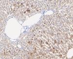 ALDH4A1 Antibody in Immunohistochemistry (Paraffin) (IHC (P))