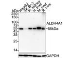 ALDH4A1 Antibody in Western Blot (WB)