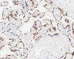 IMP3 Antibody in Immunohistochemistry (Paraffin) (IHC (P))