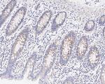 DVL2 Antibody in Immunohistochemistry (Paraffin) (IHC (P))
