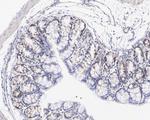 DVL2 Antibody in Immunohistochemistry (Paraffin) (IHC (P))