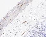 Tau Antibody in Immunohistochemistry (Paraffin) (IHC (P))