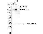 FBXL10 Antibody in Immunoprecipitation (IP)