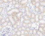 K-cadherin Antibody in Immunohistochemistry (Paraffin) (IHC (P))