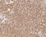 AGL Antibody in Immunohistochemistry (Paraffin) (IHC (P))