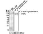 AGL Antibody in Western Blot (WB)