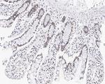 NSUN2 Antibody in Immunohistochemistry (Paraffin) (IHC (P))