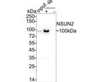 NSUN2 Antibody in Immunoprecipitation (IP)