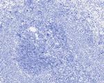Digoxin Antibody in Immunohistochemistry (Paraffin) (IHC (P))