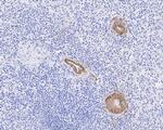 Complement C9 Antibody in Immunohistochemistry (Paraffin) (IHC (P))
