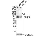 Complement C9 Antibody in Western Blot (WB)