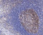 CAD Antibody in Immunohistochemistry (Paraffin) (IHC (P))