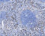 CD68 Antibody in Immunohistochemistry (Paraffin) (IHC (P))