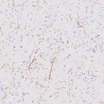 TPH2 Antibody in Immunohistochemistry (Paraffin) (IHC (P))