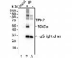 TPH2 Antibody in Immunoprecipitation (IP)