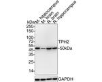 TPH2 Antibody in Western Blot (WB)