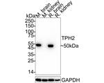 TPH2 Antibody in Western Blot (WB)