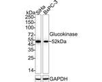 GCK Recombinant Rabbit Monoclonal Antibody (JE33-40)
