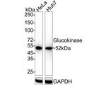 GCK Antibody in Western Blot (WB)
