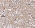 Caspase 3 p12 Antibody in Immunohistochemistry (Paraffin) (IHC (P))