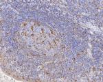 CAPG Antibody in Immunohistochemistry (Paraffin) (IHC (P))