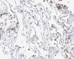 CAPG Antibody in Immunohistochemistry (Paraffin) (IHC (P))
