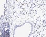 CAPG Antibody in Immunohistochemistry (Paraffin) (IHC (P))