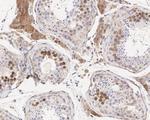 MUNC18 Antibody in Immunohistochemistry (Paraffin) (IHC (P))