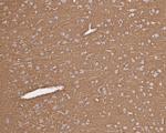 MUNC18 Antibody in Immunohistochemistry (Paraffin) (IHC (P))