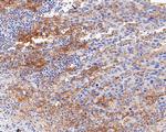 PD-L1 Antibody in Immunohistochemistry (Paraffin) (IHC (P))