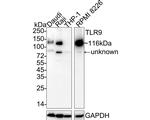 TLR9 Antibody in Western Blot (WB)