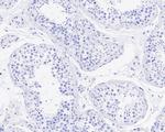 Rabbit IgG Antibody in Immunohistochemistry (Paraffin) (IHC (P))