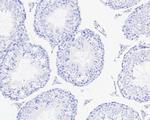Rabbit IgG Antibody in Immunohistochemistry (Paraffin) (IHC (P))