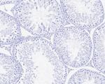 Rabbit IgG Antibody in Immunohistochemistry (Paraffin) (IHC (P))