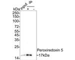 Rabbit IgG Antibody in Immunoprecipitation (IP)