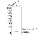 Rabbit IgG Antibody in Immunoprecipitation (IP)