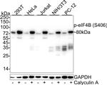 Phospho-eIF4B (Ser406) Antibody in Western Blot (WB)