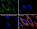 ROCK2 Recombinant Rabbit Monoclonal Antibody (JE31-36)