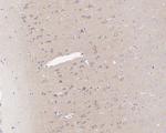 ROCK2 Antibody in Immunohistochemistry (Paraffin) (IHC (P))