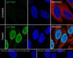 p57 Kip2 Recombinant Rabbit Monoclonal Antibody (JE02-08)