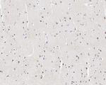 p57 Kip2 Antibody in Immunohistochemistry (Paraffin) (IHC (P))