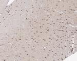 p57 Kip2 Antibody in Immunohistochemistry (Paraffin) (IHC (P))