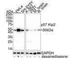 p57 Kip2 Antibody in Western Blot (WB)