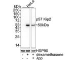 p57 Kip2 Antibody in Western Blot (WB)